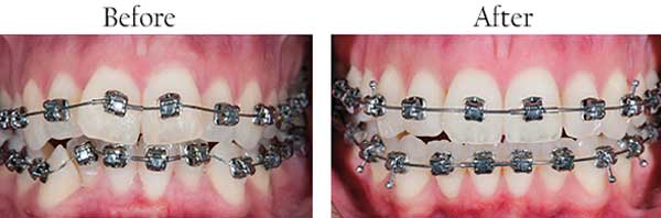 Paradise dental images